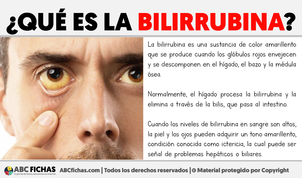 Que es la bilirrubina
