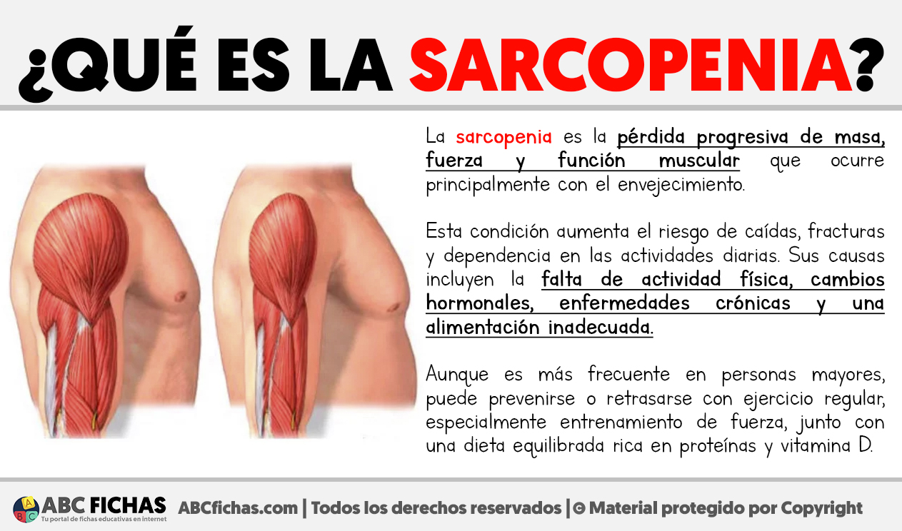 Que es la sarcopenia