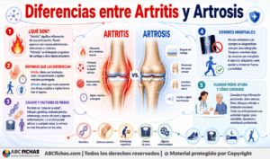 Infografia sobre Diferencias entre Artritis y Artrosis
